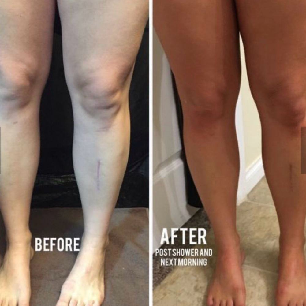 Half Tan Upper Or Lower Body at Siren Aesthetics & Spa in Greenfield, IN