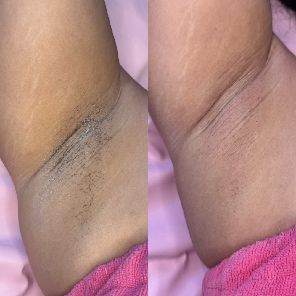 Underarm Wax