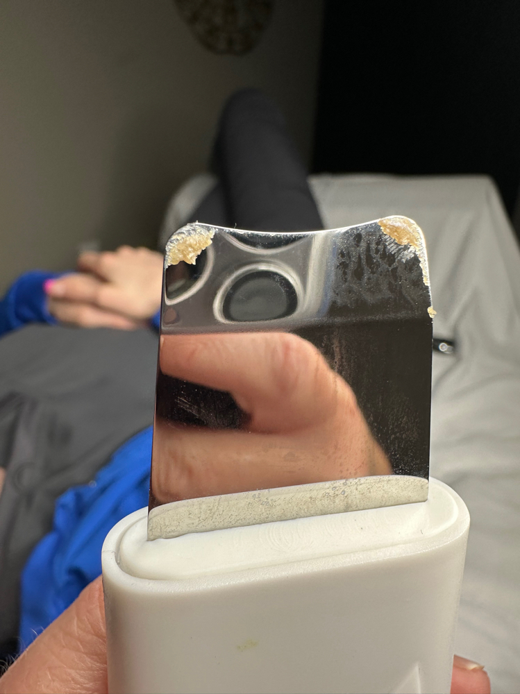 Ultra Sonic Therapy Add On