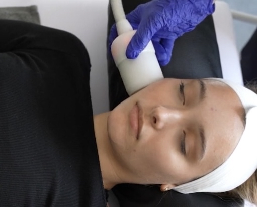 Red Carpet Facial “CryoFacial”