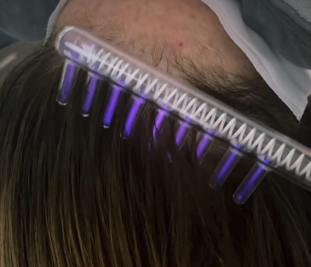 Stimulating Scalp Treatment