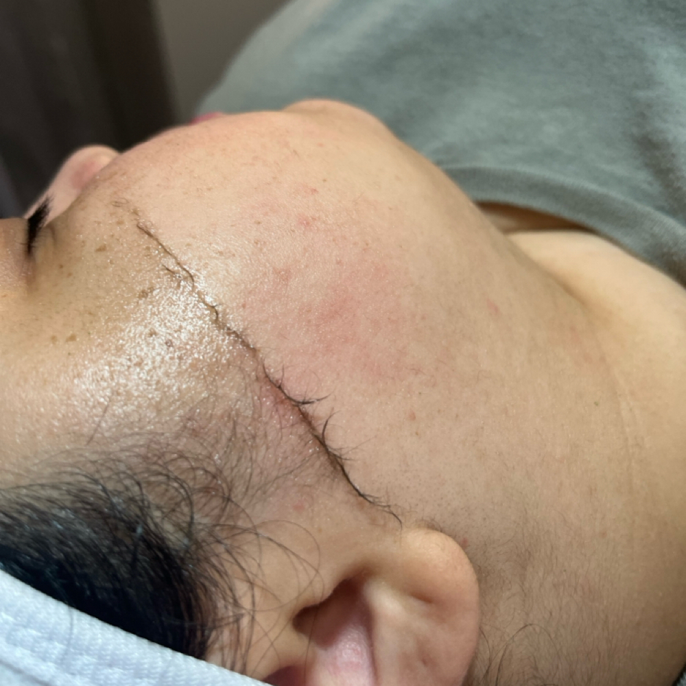 Facial + Dermaplane at CC's House of Esthetics in Camarillo, CA