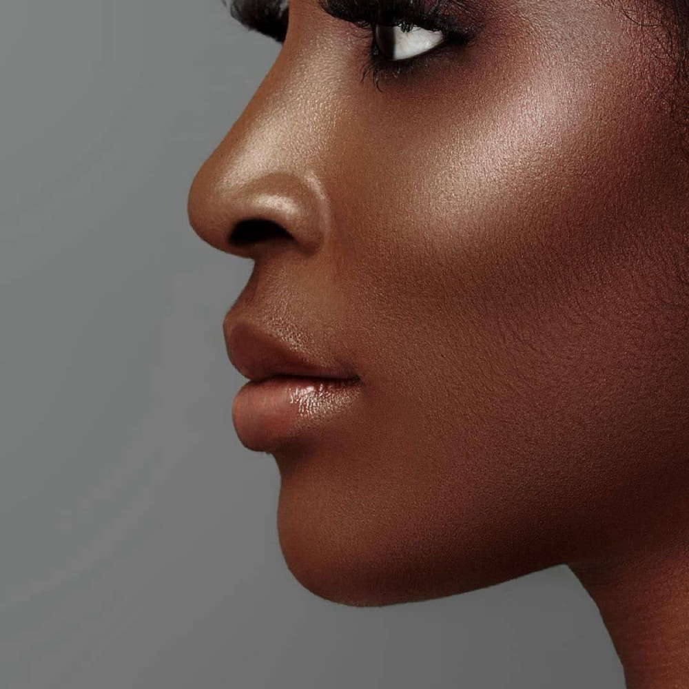 Sides Of Face at Andrew Gaines Aesthetics in Warner Robins, GA