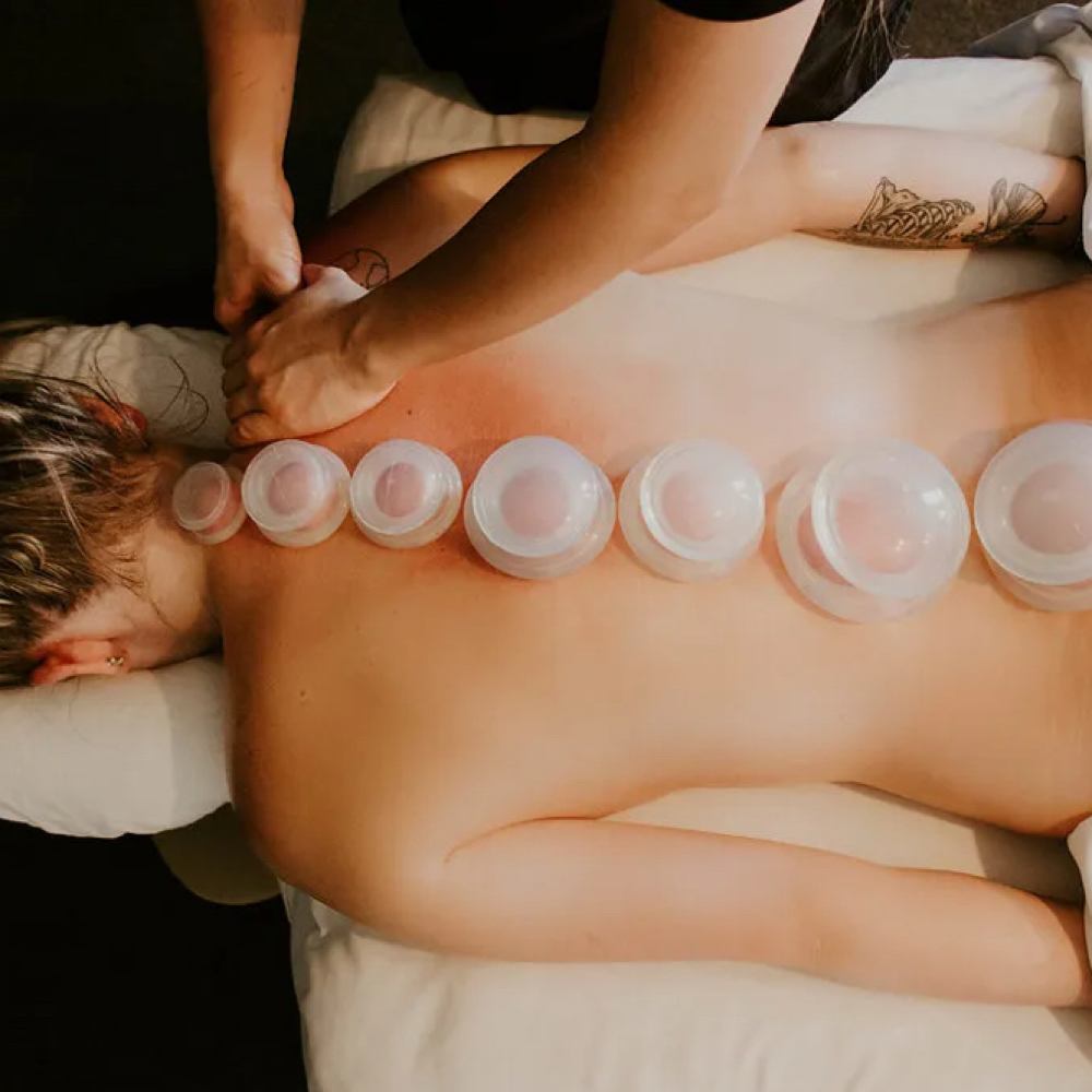 Cupping at The Mend Integrative in Gastonia, NC