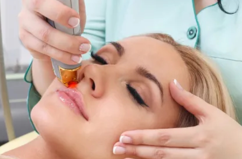 Facial Hair Removal at Elevate Aesthetics in Trumann, AR