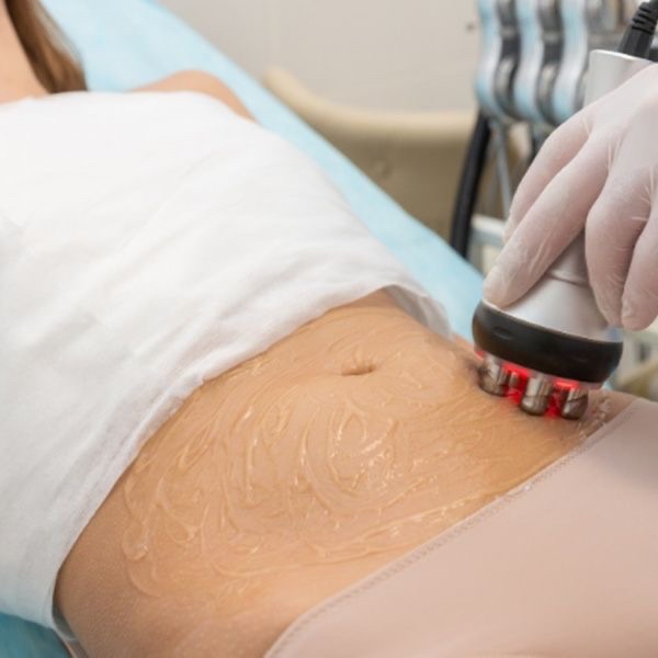 Radio Frequency at Des Beauty & Skin in El Paso, TX