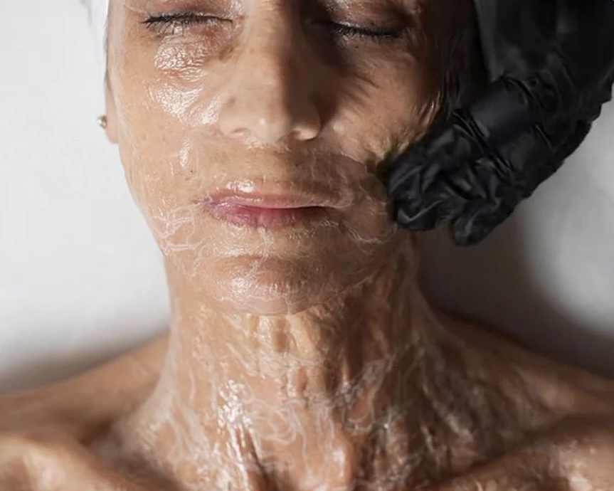Korean Botox Facial