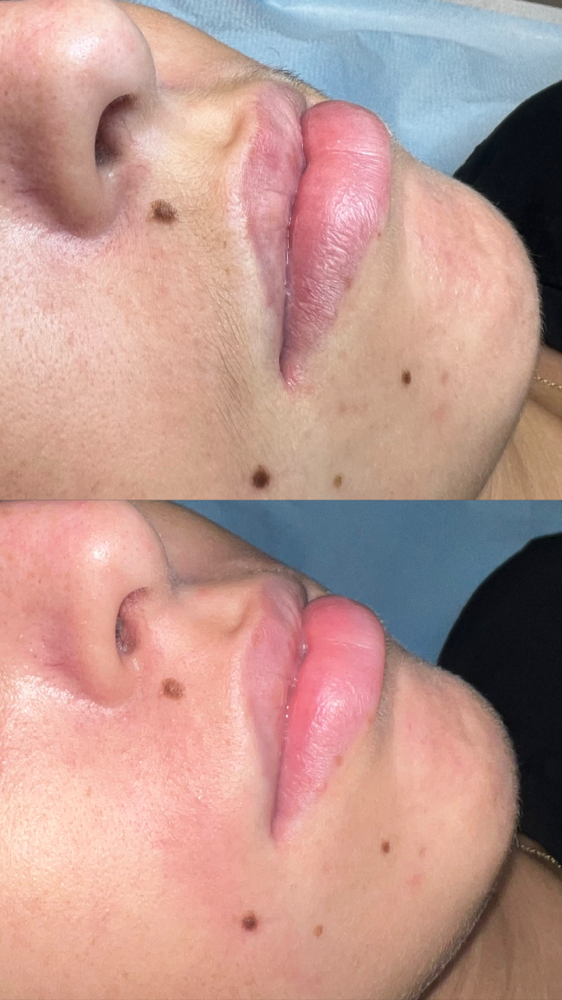 Upper Lip Wax