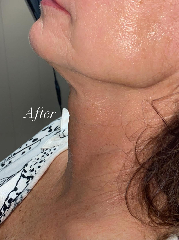 Package Of 3 “turkey Neck” at J Artistry in Sherman, TX