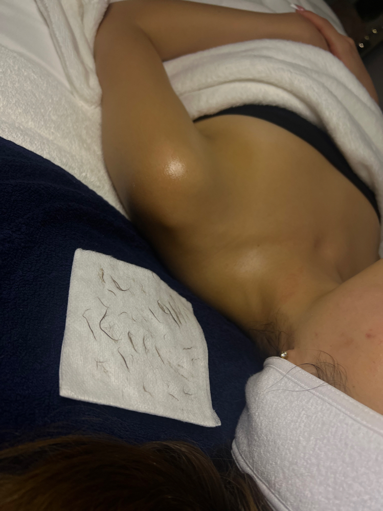 Dermaplaning Facial