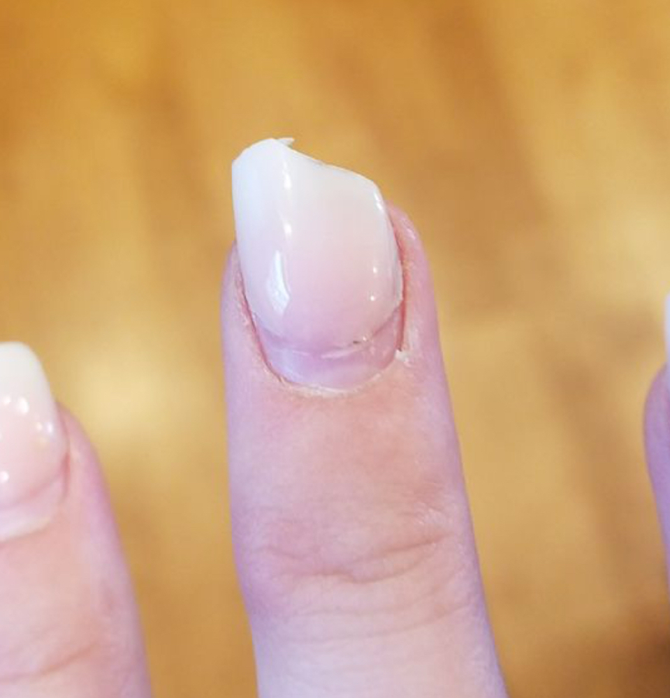 Nail Repair