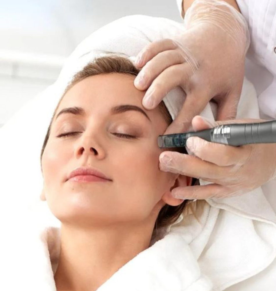 Microneedling