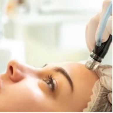 Hydra-dermabrasion | Add-on at Vice Kingz Esthetics in Murrieta, CA