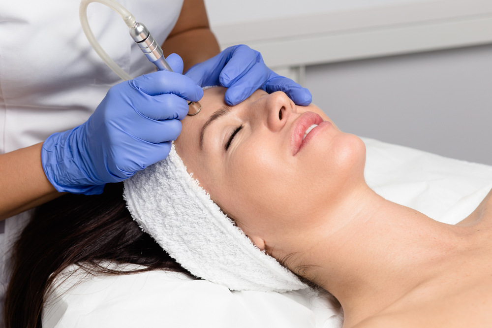 Micro-Dermabrasion Treatment