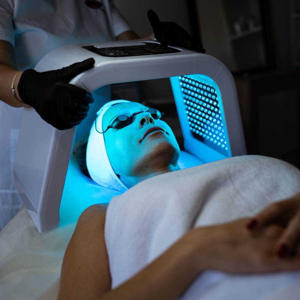 Acne Scars & Hyperpigmentation