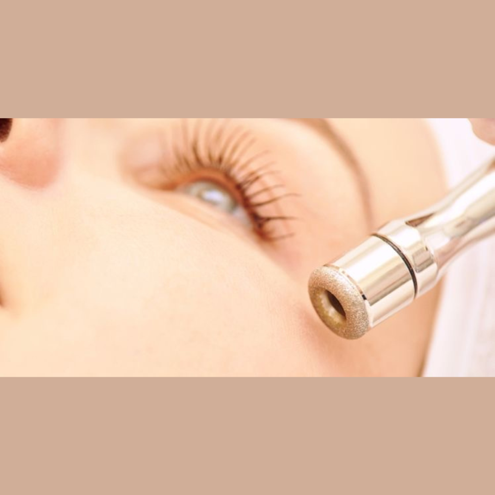 Microdermabrasion Facial
