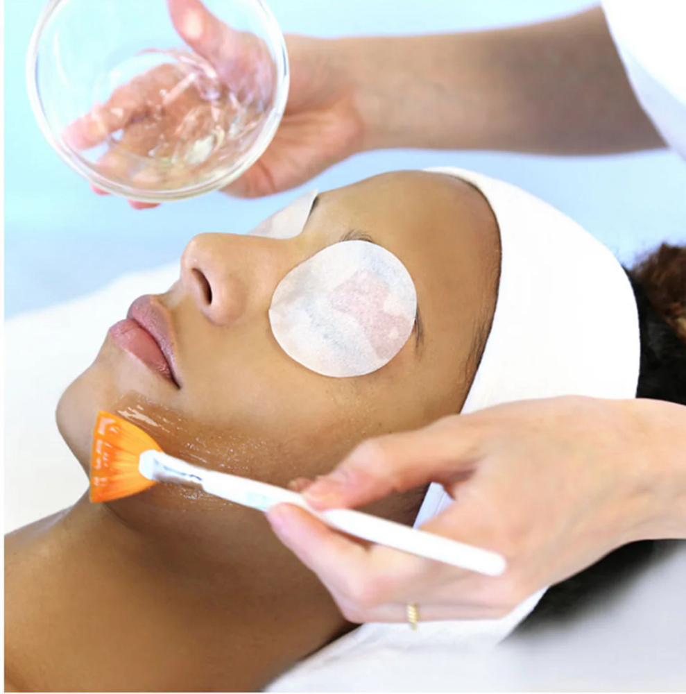 Sacicylic Acid Peel