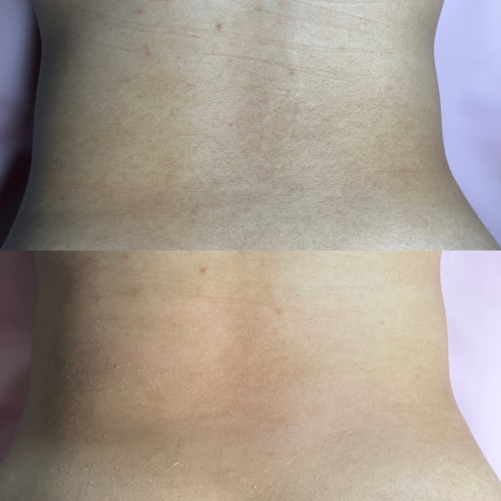 Womens Lower Back