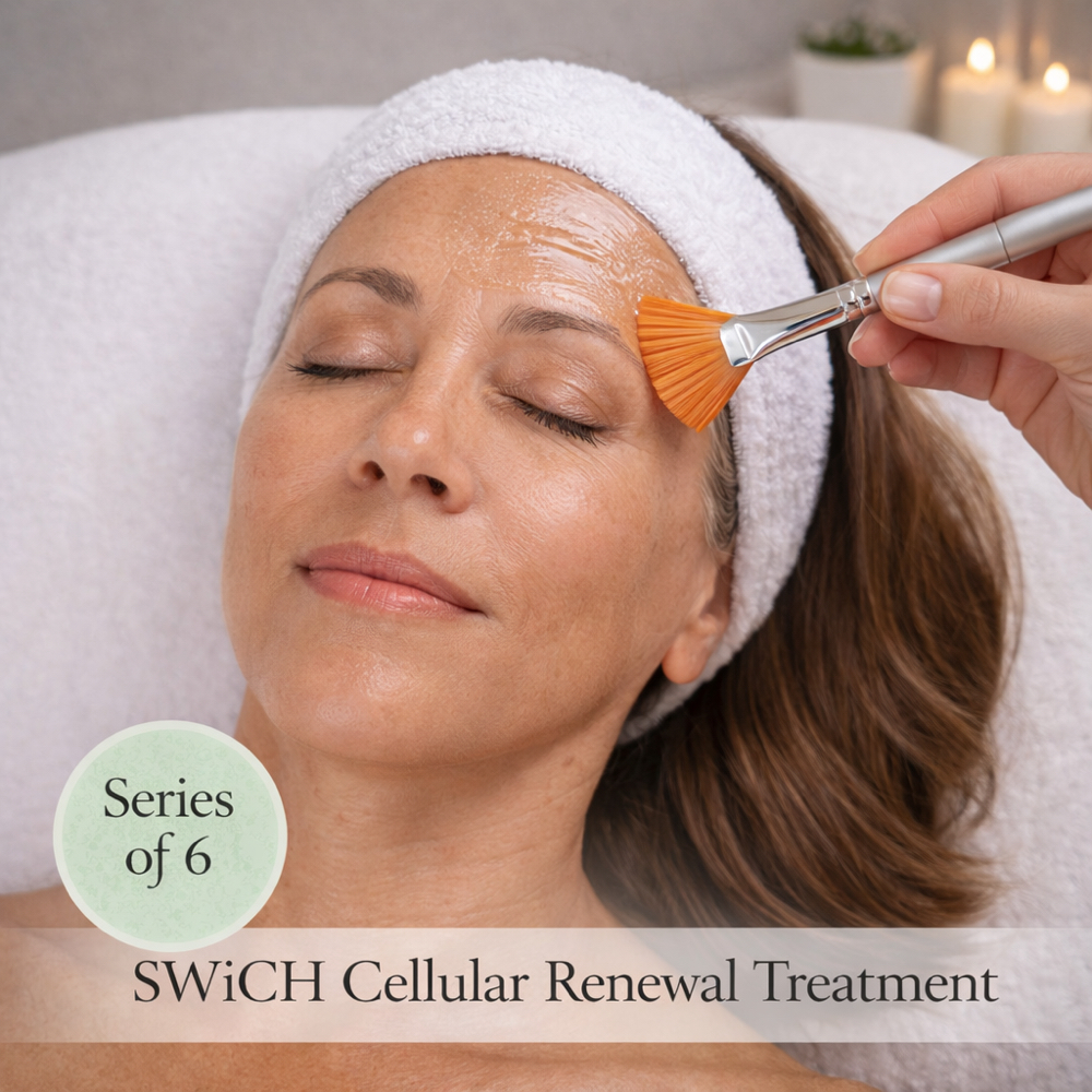 Switch Cellular Renewal Series of 6 at Auralie Aesthetics in Bradenton, FL