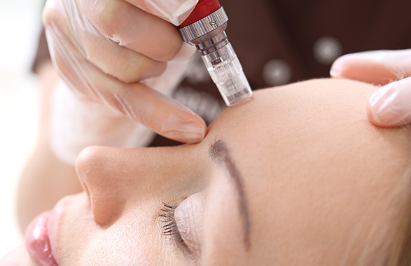 Microneedling With Dermaplane