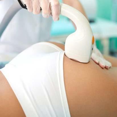 Buttock Laser Hair Removal