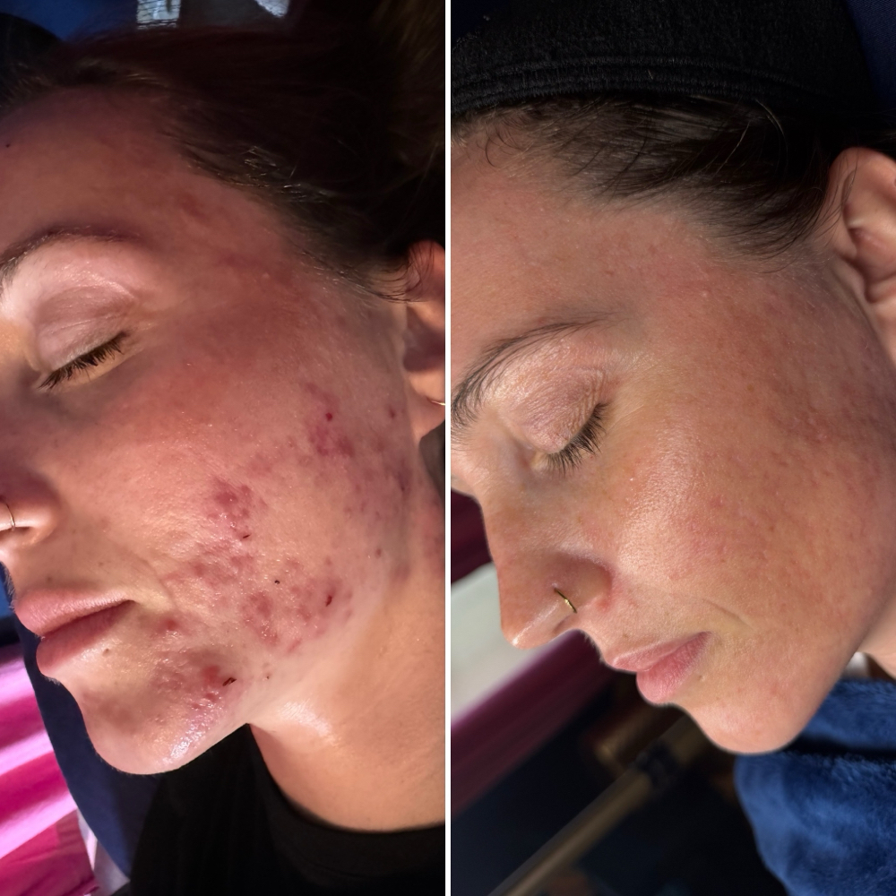 *NEW CLIENT* Facial