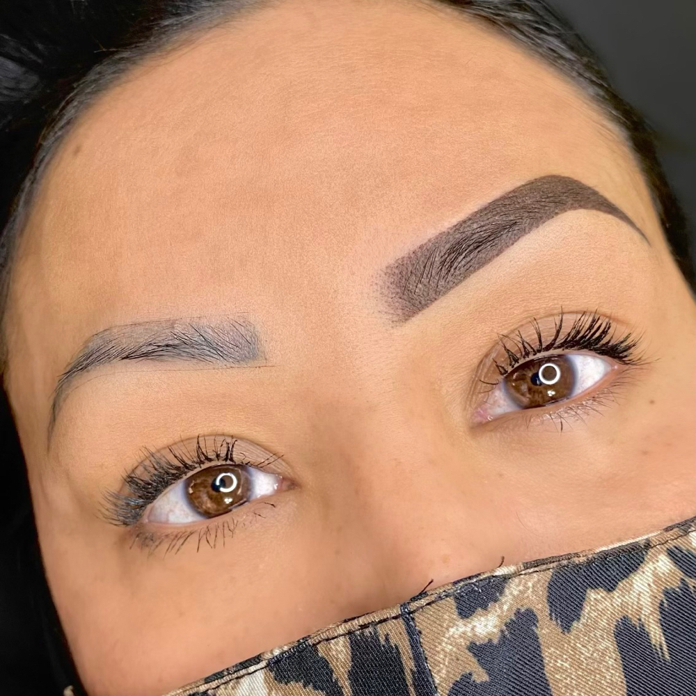 Brow Correction