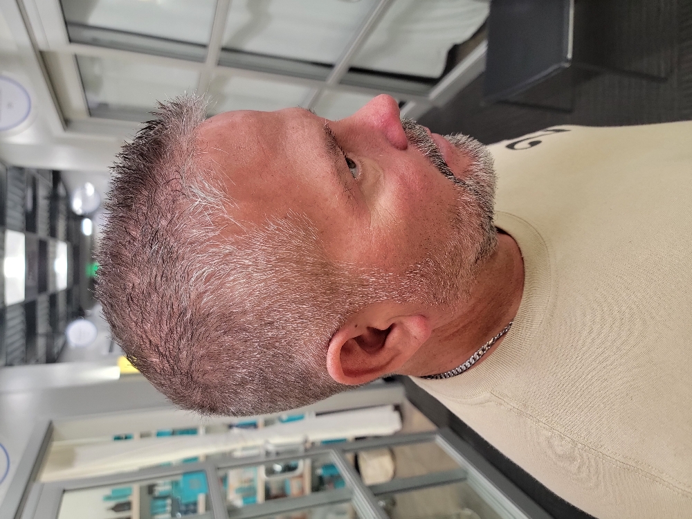 Beard Trim