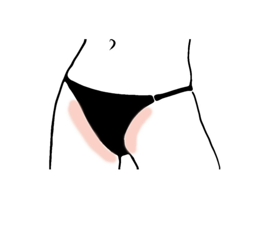 Basic Bikini