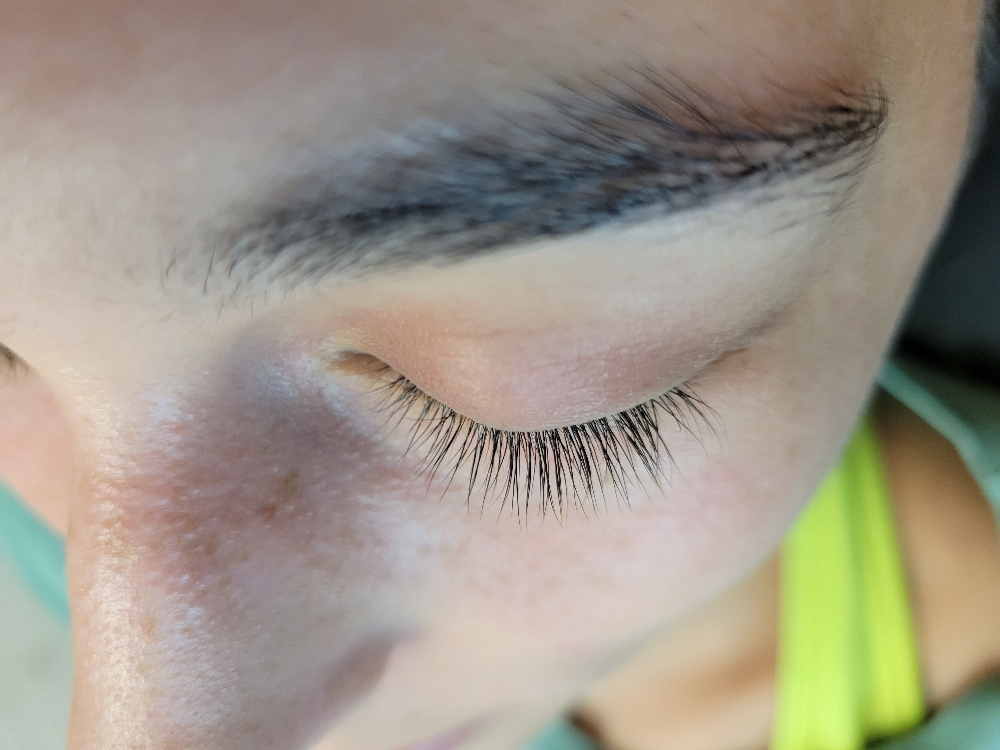 Lash Removal