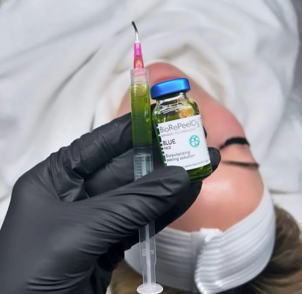Biorepeel Treatment