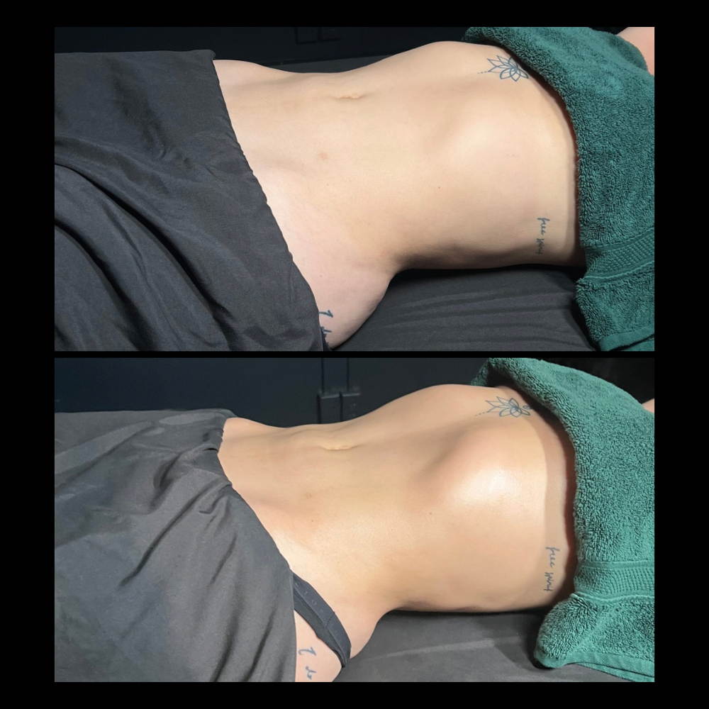 Full-Body Lymphatic LUXE at Trinity Wellness Co. in Riverside, CA
