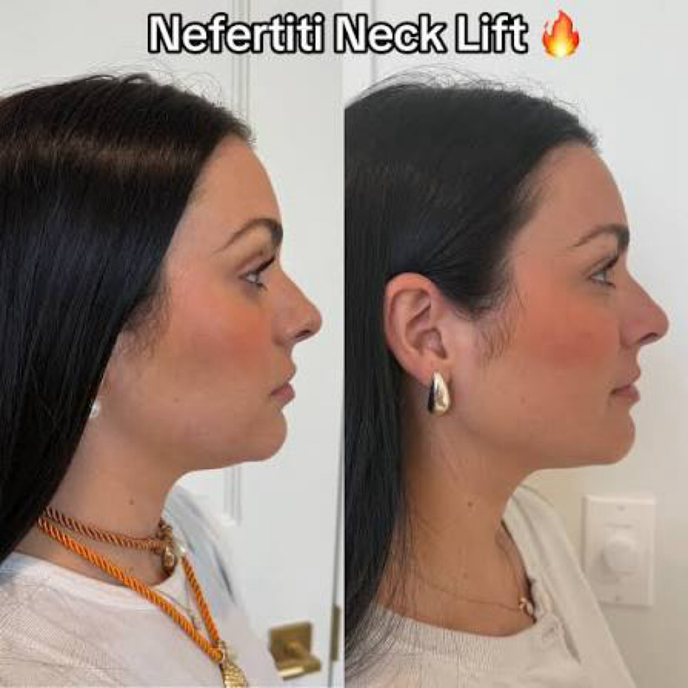 (NEW Service!!!)Nefertiti Neck Lift at Kalifornia Klassic Beauty Lounge in Warr Acres, OK