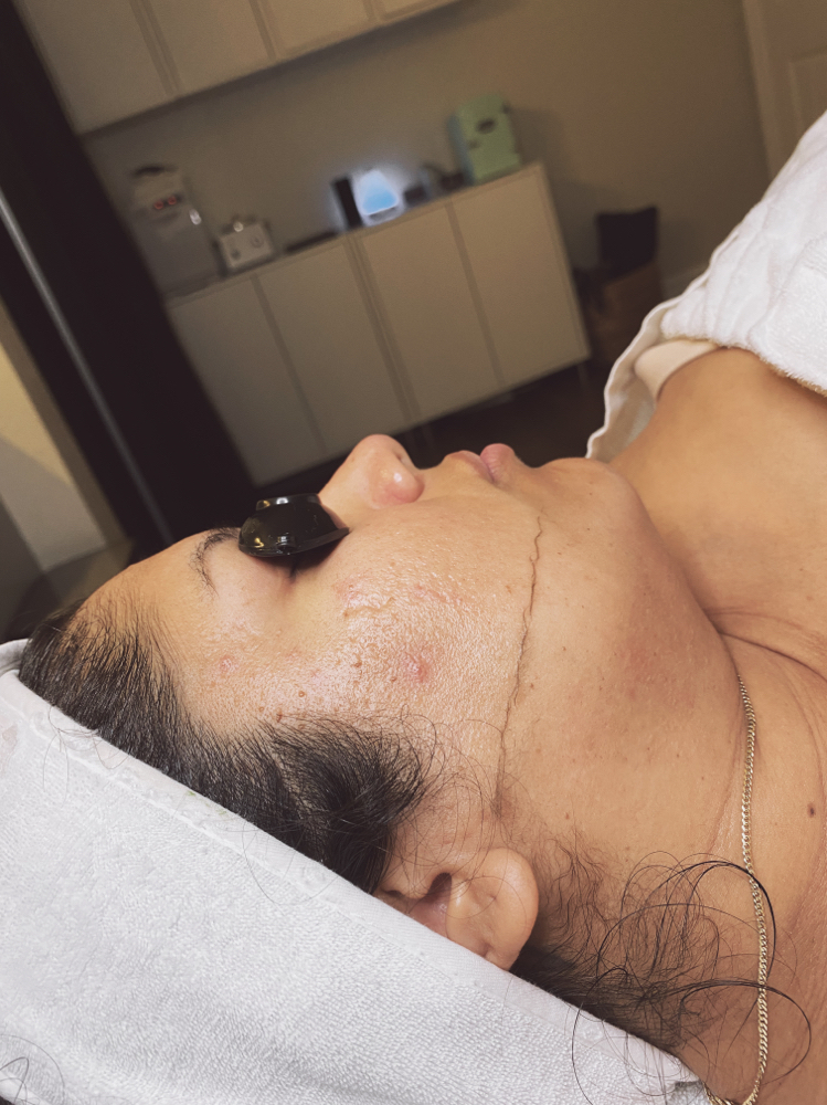 Dermaplane Facial