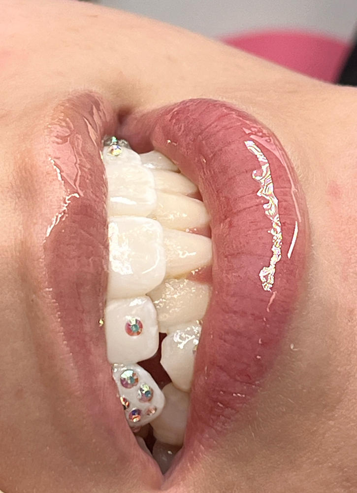 Tooth Gem