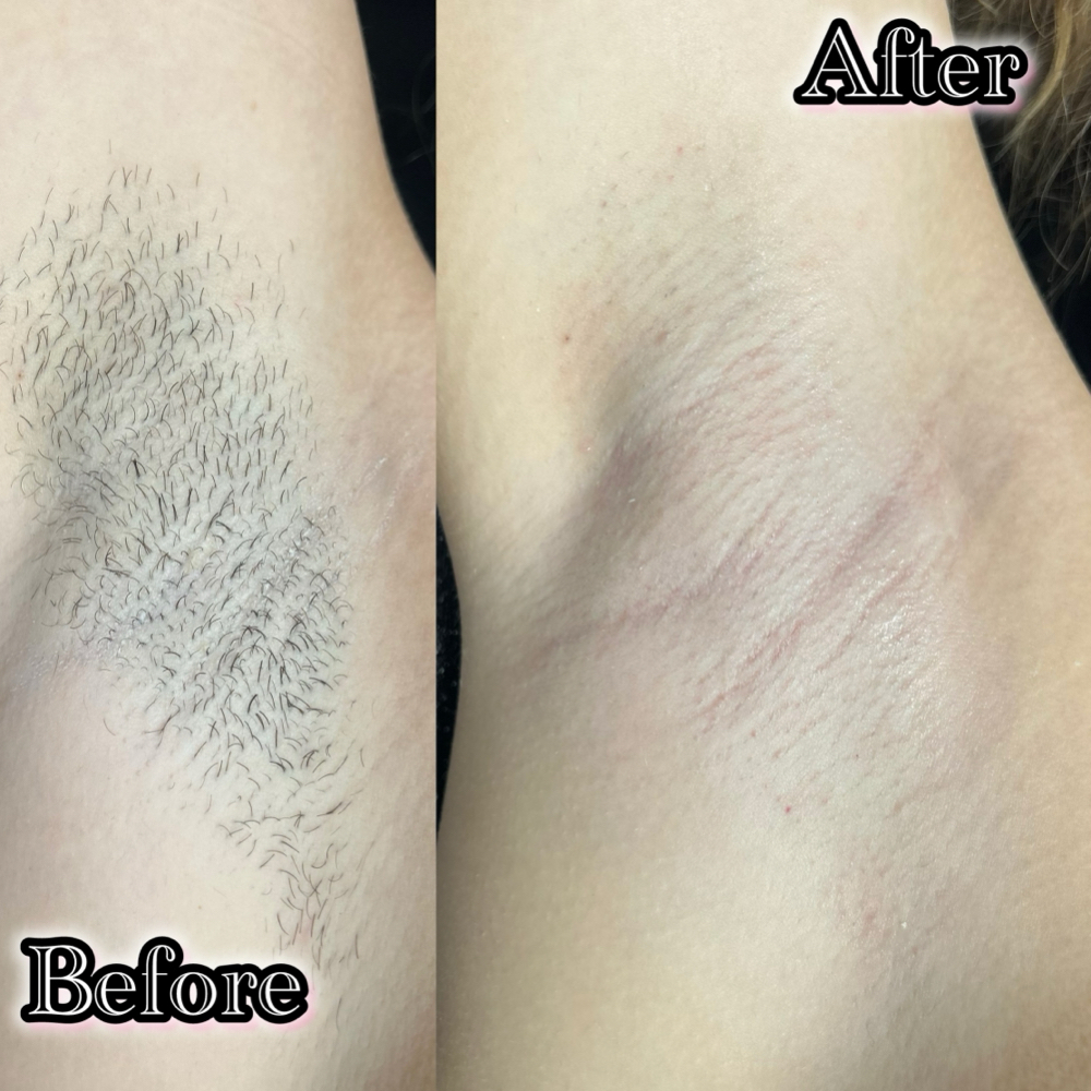 Under Arm Wax at EstheticsByTaegan in Searcy, AR