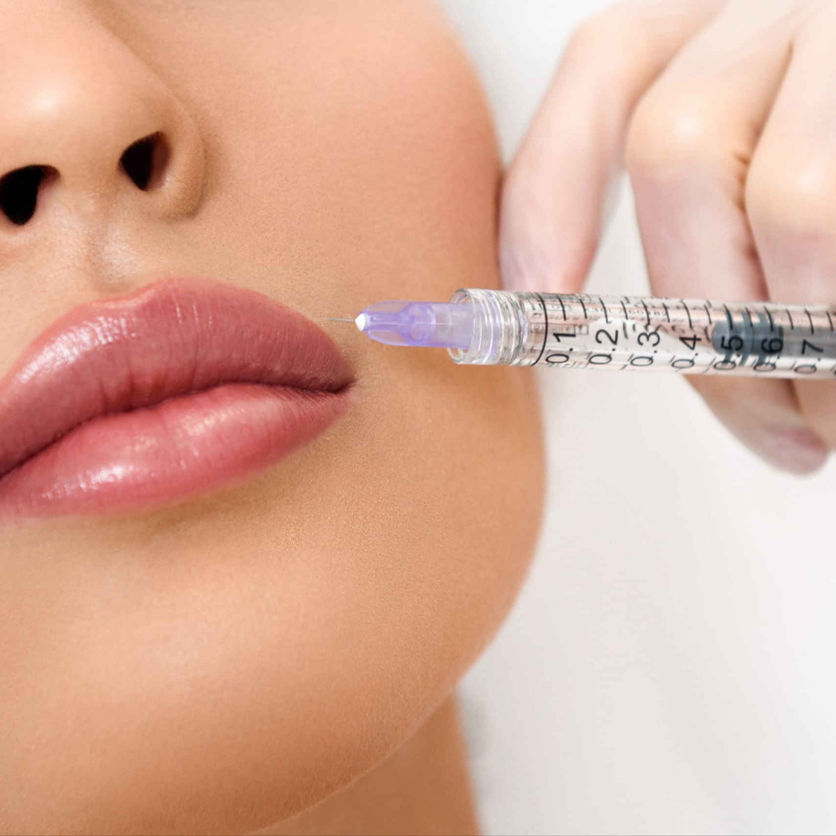 Lip Flip at E.V. Aesthetics in Torrance, CA