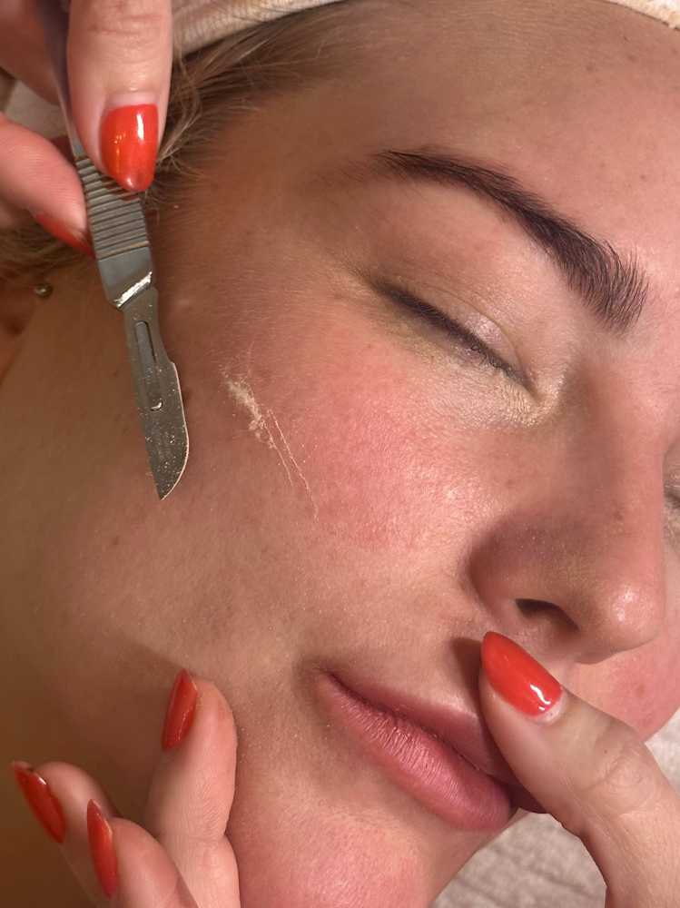 Lunch Time Dermaplane + Peel