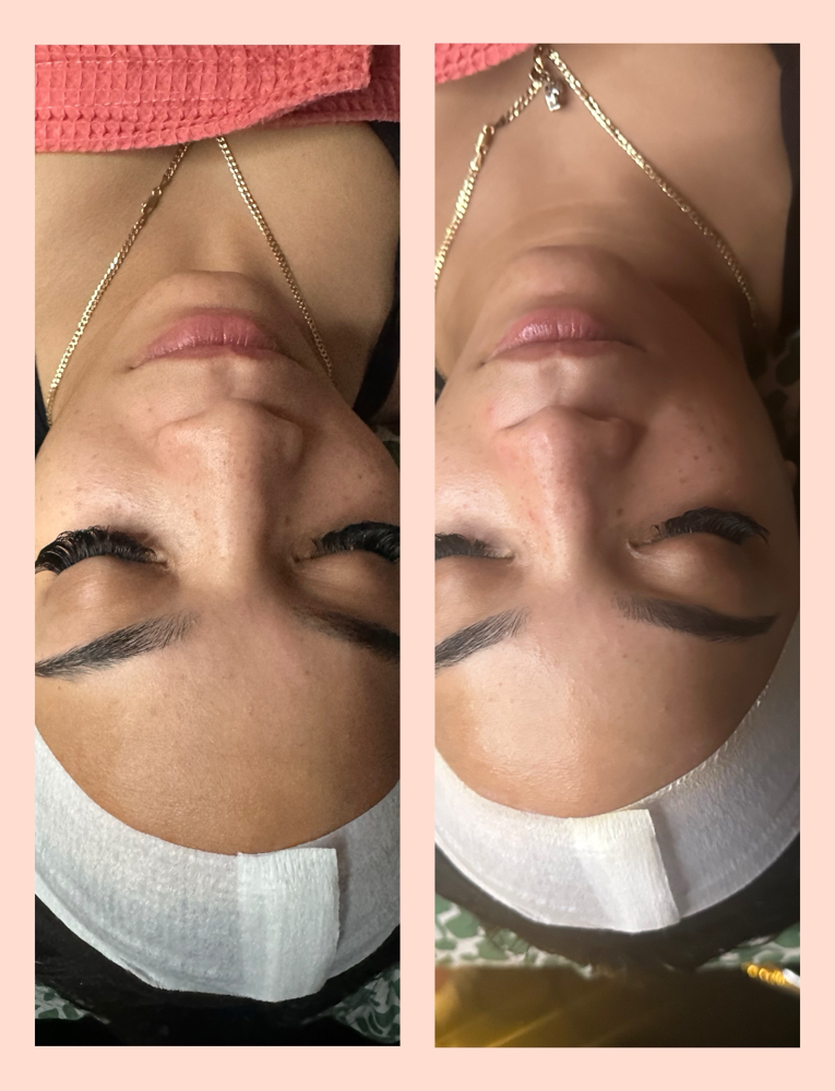 LilyLuxe Signature Facial