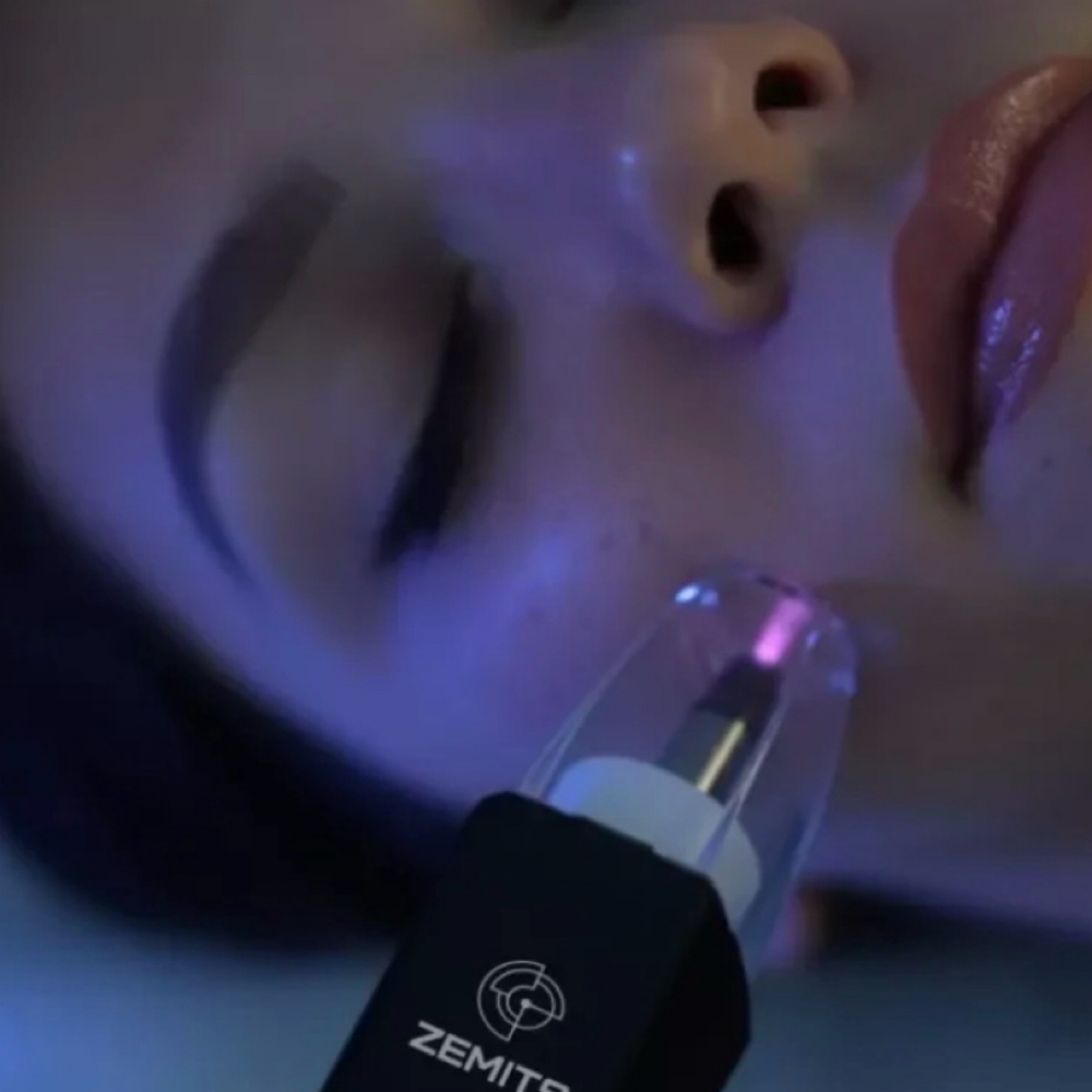 Zemits EvoPlasm Cold Plasma at HK Besthetics in San Antonio, TX