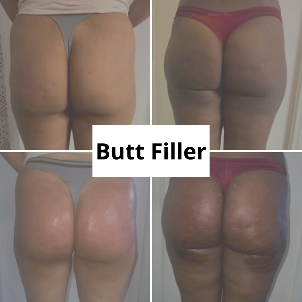 Butt Filler