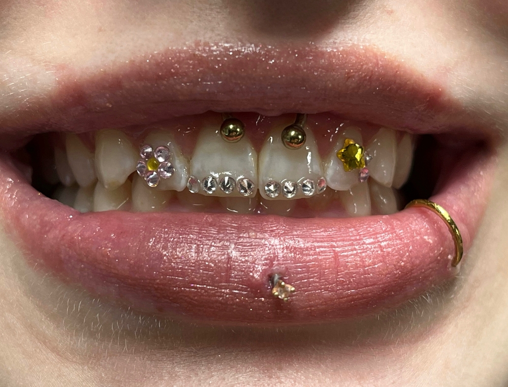 Tooth Gems