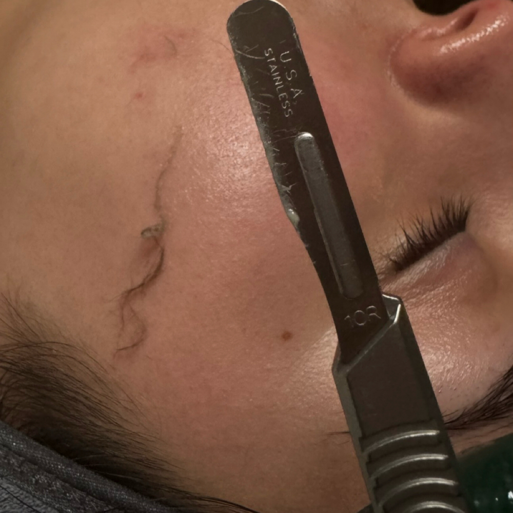 Dermaplane Facial at Skin Ritual Esthetics in Clayton, NC