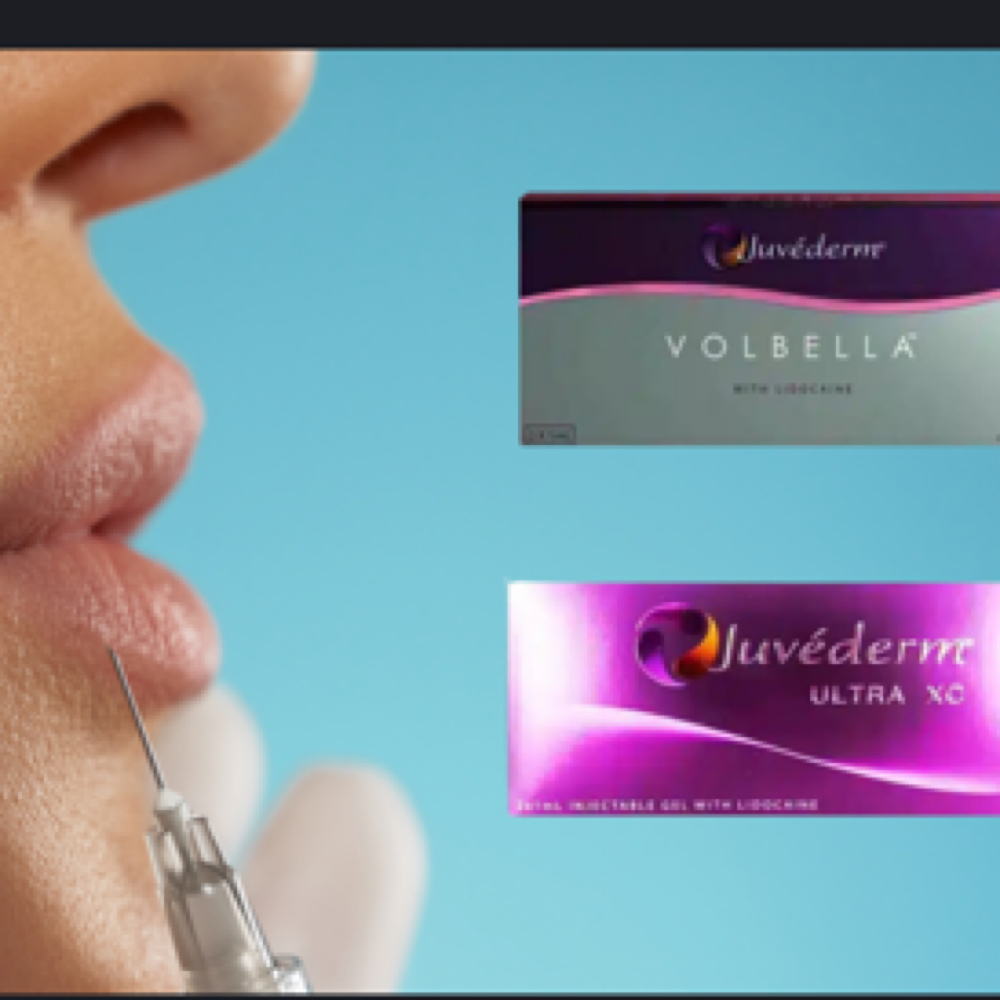 Juvederm Lip Filler at Finesse Sculpt Body Studio in Parkville, MD