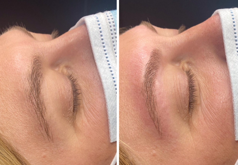 Brow Threading