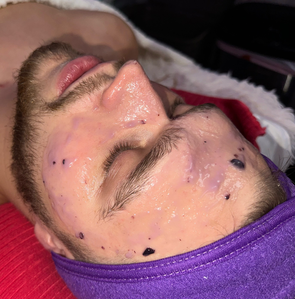 High Frequency Facial