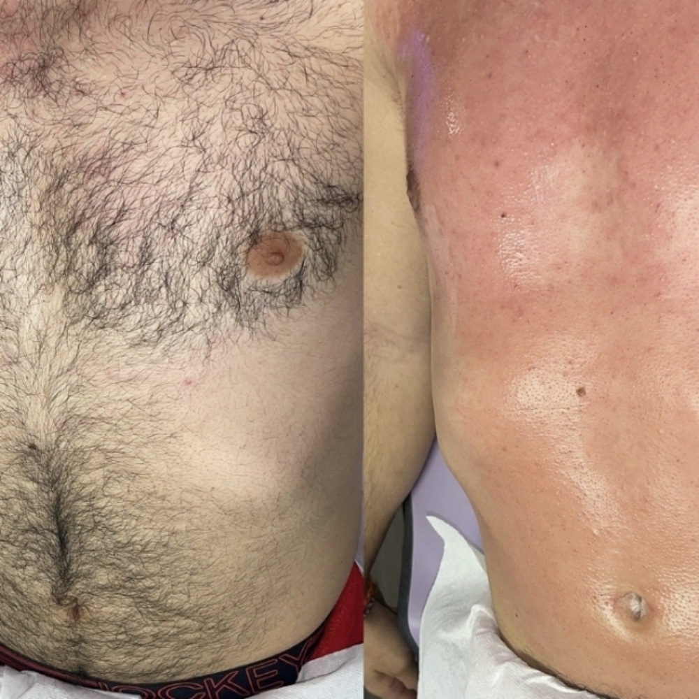 Mens Chest & Stomach Wax at Beauty For All in Chalmette, LA