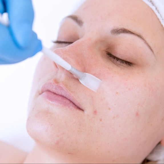 Acne Bootcamp Facial Treatment at SoLuna Aesthetics in Scottsdale, AZ