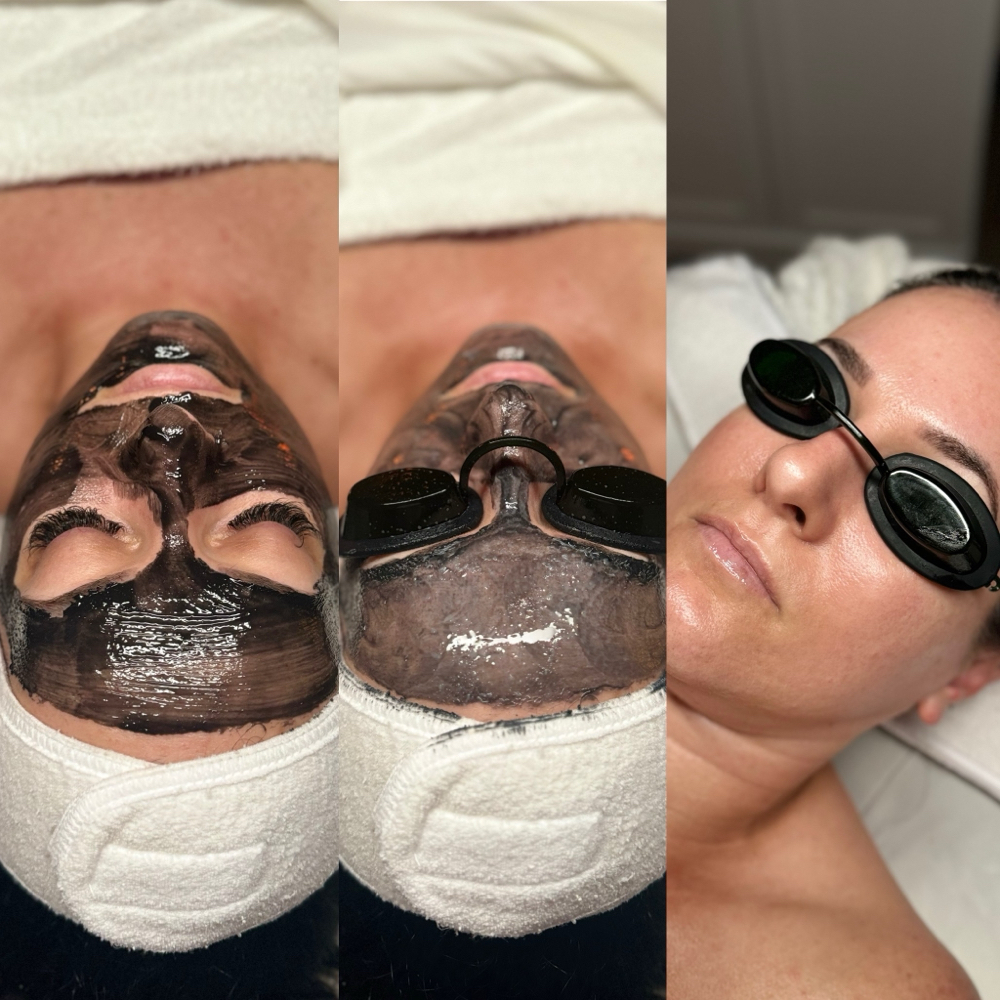 Refine & Recover Facial