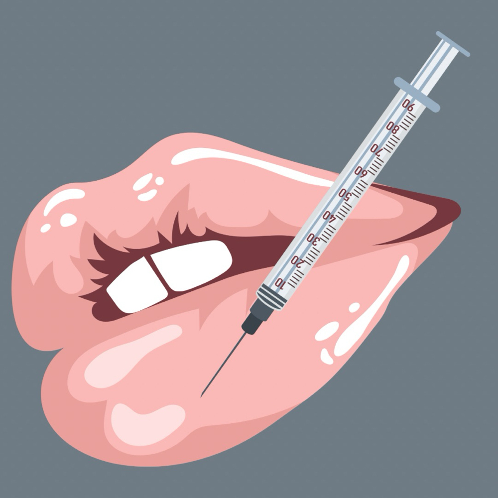 Botox - Lip Flip